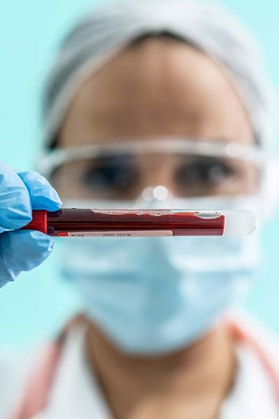 Doctor holding blood vial