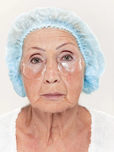 anti aging facial tucson 