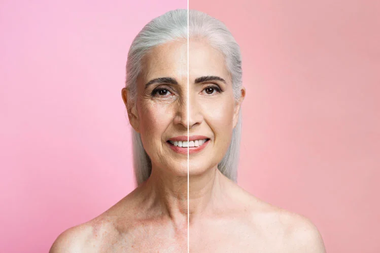 aging woman