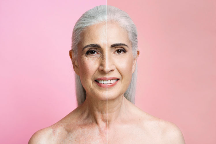 collagen loss potrait